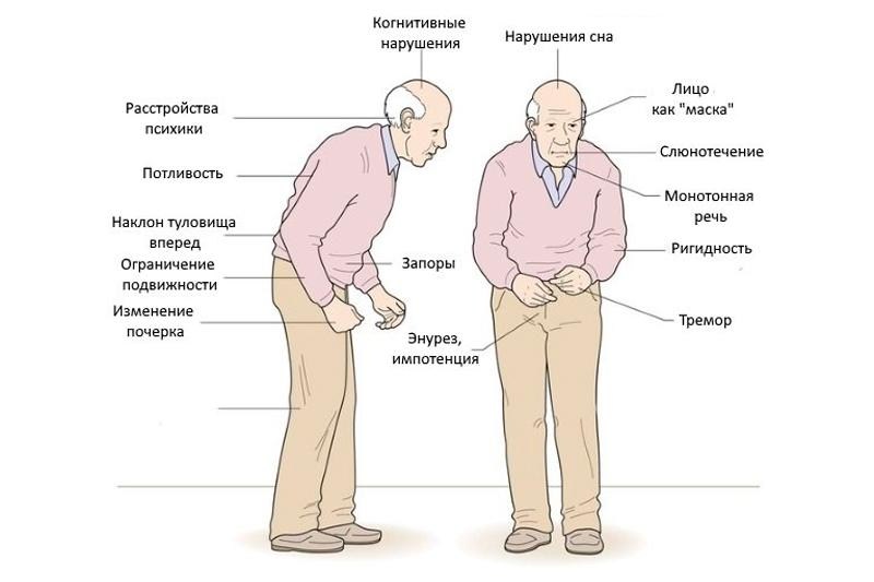 инфографика